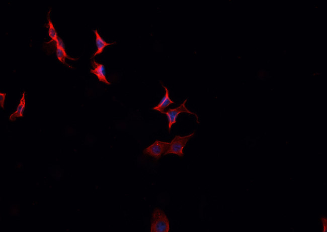C2orf40 / ECRG4 Antibody - Staining HeLa cells by IF/ICC. The samples were fixed with PFA and permeabilized in 0.1% Triton X-100, then blocked in 10% serum for 45 min at 25°C. The primary antibody was diluted at 1:200 and incubated with the sample for 1 hour at 37°C. An Alexa Fluor 594 conjugated goat anti-rabbit IgG (H+L) antibody, diluted at 1/600, was used as secondary antibody.