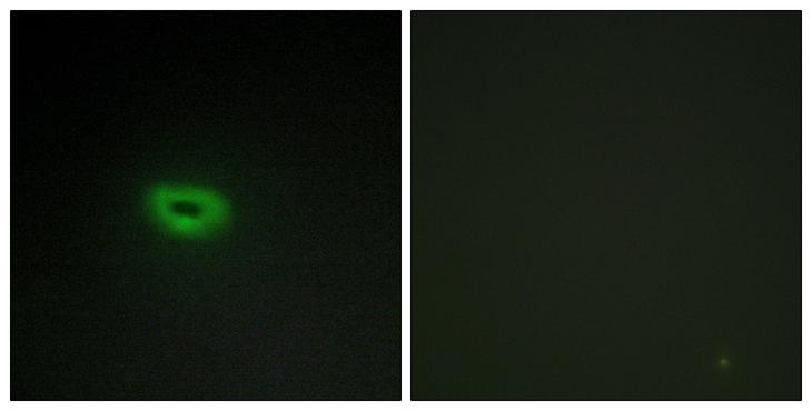 C2orf40 / ECRG4 Antibody - Peptide - + Immunofluorescence analysis of A549 cells, using ECRG4 antibody.