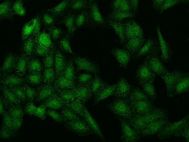 C2orf42 Antibody - Immunofluorescence staining of C2orf42 in U2OS cells. Cells were fixed with 4% PFA, permeabilzed with 0.1% Triton X-100 in PBS, blocked with 10% serum, and incubated with rabbit anti-Human C2orf42 polyclonal antibody (dilution ratio 1:200) at 4°C overnight. Then cells were stained with the Alexa Fluor 488-conjugated Goat Anti-rabbit IgG secondary antibody (green). Positive staining was localized to Nucleus and cytoplasm.