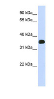 C2orf47 Antibody - C2orf47 antibody Western blot of Fetal Liver lysate. This image was taken for the unconjugated form of this product. Other forms have not been tested.