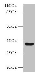 C2orf47 Antibody - Western blot All lanes: MAIP1 antibody at 2µg/ml + Mouse kidney tissue Secondary Goat polyclonal to rabbit IgG at 1/10000 dilution Predicted band size: 33 kDa Observed band size: 33 kDa