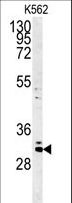 C2orf49 Antibody - Western blot of C2orf49 Antibody in K562 cell line lysates (35 ug/lane). C2orf49 (arrow) was detected using the purified antibody.