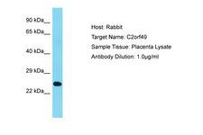 C2orf49 Antibody -  This image was taken for the unconjugated form of this product. Other forms have not been tested.