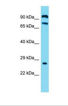 C2orf70 Antibody - Western blot of Human OVCAR-3. C2orf70 antibody dilution 1.0 ug/ml.  This image was taken for the unconjugated form of this product. Other forms have not been tested.