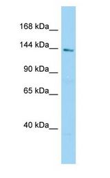 C2orf71 Antibody - C2orf71 antibody Western Blot of Fetal kidney.  This image was taken for the unconjugated form of this product. Other forms have not been tested.