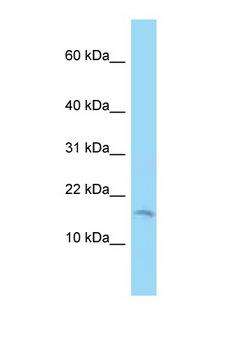 C2orf76 Antibody - C2orf76 antibody Western blot of 721_B Cell lysate. Antibody concentration 1 ug/ml.  This image was taken for the unconjugated form of this product. Other forms have not been tested.