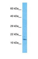 C2orf76 Antibody - Western blot of CB076 Antibody with human HepG2 Whole Cell lysate.  This image was taken for the unconjugated form of this product. Other forms have not been tested.