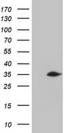 C2orf80 Antibody - HEK293T cells were transfected with the pCMV6-ENTRY control. (Left lane) or pCMV6-ENTRY C2orf80. (Right lane) cDNA for 48 hrs and lysed. Equivalent amounts of cell lysates. (5 ug per lane) were separated by SDS-PAGE and immunoblotted with anti-C2orf80. (1:2000)(1:500)