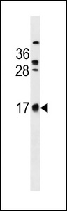 C2orf83 Antibody - CB083 Antibody western blot of CEM cell line lysates (35 ug/lane). The CB083 Antibody detected the CB083 protein (arrow).