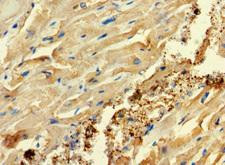 C2orf83 Antibody - Immunohistochemistry of paraffin-embedded human heart tissue using C2orf83 Antibody at dilution of 1:100