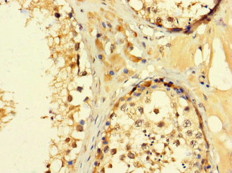C2orf83 Antibody - Immunohistochemistry of paraffin-embedded human testis tissue using C2orf83 Antibody at dilution of 1:100