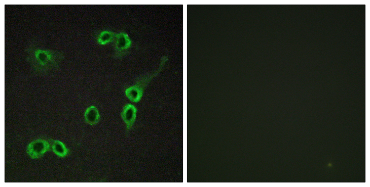 C3AR / C3a Receptor Antibody - Immunofluorescence analysis of COS7 cells, using C3AR1 Antibody. The picture on the right is blocked with the synthesized peptide.