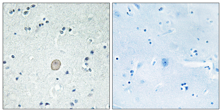 C3AR / C3a Receptor Antibody - Immunohistochemistry analysis of paraffin-embedded human brain tissue, using C3AR1 Antibody. The picture on the right is blocked with the synthesized peptide.