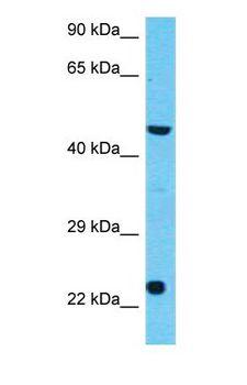 C3AR / C3a Receptor Antibody - Western blot of C3AR1 Antibody with human 293T Whole Cell lysate.  This image was taken for the unconjugated form of this product. Other forms have not been tested.