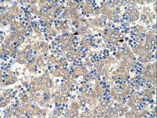 C3orf10 Antibody - C3orf10 antibody C3ORF10 Antibody was used in IHC to stain formalin-fixed, paraffin-embedded human liver.  This image was taken for the unconjugated form of this product. Other forms have not been tested.