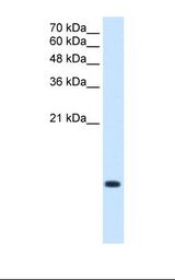 C3orf10 Antibody - Lane A: Marker. Lane B: HepG2 cell lysate. Antibody concentration: 2.5 ug/ml. Gel concentration: 15%.  This image was taken for the unconjugated form of this product. Other forms have not been tested.