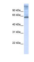 C3orf17 / NET17 Antibody - C3orf17 antibody Western blot of 721_B cell lysate. This image was taken for the unconjugated form of this product. Other forms have not been tested.