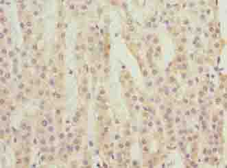 C3orf18 Antibody - Immunohistochemistry of paraffin-embedded human adrenal gland tissue using antibody at dilution of 1:100.