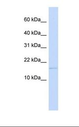 C3orf18 Antibody - 721_B cell lysate. Antibody concentration: 1.0 ug/ml. Gel concentration: 10-20%.  This image was taken for the unconjugated form of this product. Other forms have not been tested.
