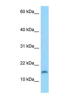 C3orf22 Antibody - C3orf22 antibody Western blot of HepG2 Cell lysate. Antibody concentration 1 ug/ml.  This image was taken for the unconjugated form of this product. Other forms have not been tested.