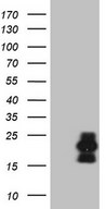 C3orf36 Antibody - HEK293T cells were transfected with the pCMV6-ENTRY control. (Left lane) or pCMV6-ENTRY C3orf36. (Right lane) cDNA for 48 hrs and lysed. Equivalent amounts of cell lysates. (5 ug per lane) were separated by SDS-PAGE and immunoblotted with anti-C3orf36. (1:2000)