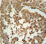 C3orf58 Antibody - CC058 Antibody immunohistochemistry of formalin-fixed and paraffin-embedded human testis tissue followed by peroxidase-conjugated secondary antibody and DAB staining.