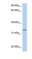 C3orf62 Antibody - C3orf62 antibody Western blot of MCF7 cell lysate. This image was taken for the unconjugated form of this product. Other forms have not been tested.