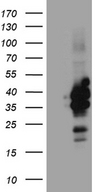 C3orf62 Antibody - HEK293T cells were transfected with the pCMV6-ENTRY control. (Left lane) or pCMV6-ENTRY C3orf62. (Right lane) cDNA for 48 hrs and lysed. Equivalent amounts of cell lysates. (5 ug per lane) were separated by SDS-PAGE and immunoblotted with anti-C3orf62. (1:2000)