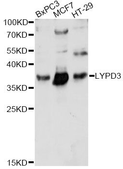 C4.4A / LYPD3 Antibody - Western blot analysis of extracts of various cell lines, using LYPD3 antibody at 1:1000 dilution. The secondary antibody used was an HRP Goat Anti-Rabbit IgG (H+L) at 1:10000 dilution. Lysates were loaded 25ug per lane and 3% nonfat dry milk in TBST was used for blocking. An ECL Kit was used for detection and the exposure time was 30s.