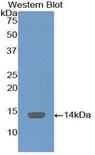 C4BPA / C4BP Alpha Antibody - Western blot of recombinant C4BPA / C4BP.  This image was taken for the unconjugated form of this product. Other forms have not been tested.