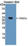 C4BPA / C4BP Alpha Antibody - Western blot of C4BPA / C4BP Alpha antibody.