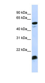 C4BPA / C4BP Alpha Antibody - C4BPA antibody Western blot of MCF7 cell lysate.  This image was taken for the unconjugated form of this product. Other forms have not been tested.