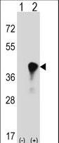 C4BPB / C4BP Beta Antibody - Western blot of C4BPB (arrow) using rabbit polyclonal C4BPB Antibody. 293 cell lysates (2 ug/lane) either nontransfected (Lane 1) or transiently transfected (Lane 2) with the C4BPB gene.