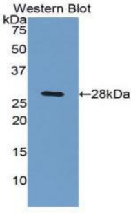 C4BPB / C4BP Beta Antibody - Western blot of recombinant C4BPB / C4BP.  This image was taken for the unconjugated form of this product. Other forms have not been tested.