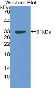 C4BPB / C4BP Beta Antibody - Western Blot; Sample: Recombinant protein.