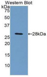 C4BPB / C4BP Beta Antibody - Western blot of recombinant C4BPB / C4BP.
