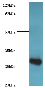 C4BPB / C4BP Beta Antibody - Western blot. All lanes: C4b-binding protein beta chain antibody at 6 ug/ml+mouse liver tissue. Secondary antibody: Goat polyclonal to rabbit at 1:10000 dilution. Predicted band size: 28 kDa. Observed band size: 28 kDa Immunohistochemistry.