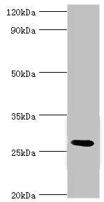 C4BPB / C4BP Beta Antibody - Western blot All lanes: C4b-binding protein beta chain antibody at 6µg/ml + Mouse liver tissue Secondary Goat polyclonal to rabbit IgG at 1/10000 dilution Predicted band size: 28 kDa Observed band size: 28 kDa
