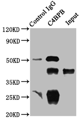 C4BPB / C4BP Beta Antibody - Immunoprecipitating C4BPB in HepG2 whole cell lysate Lane 1: Rabbit control IgG instead of C4BPB Antibody in HepG2 whole cell lysate.For western blotting, a HRP-conjugated Protein G antibody was used as the secondary antibody (1/2000) Lane 2: C4BPB Antibody (8µg) + HepG2 whole cell lysate (500µg) Lane 3: HepG2 whole cell lysate (10µg)