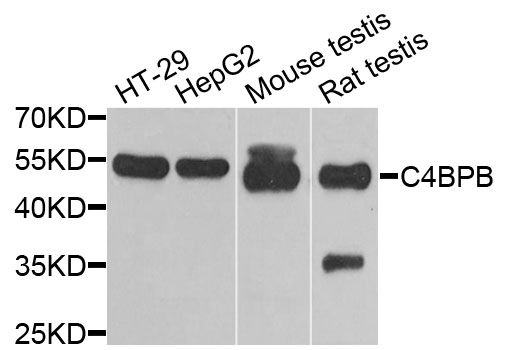 C4BPB / C4BP Beta Antibody - Western blot analysis of extracts of various cells.