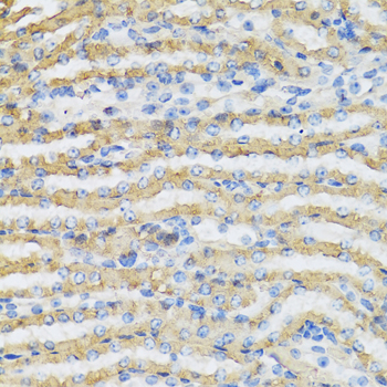 C4BPB / C4BP Beta Antibody - Immunohistochemistry of paraffin-embedded mouse kidney tissue.