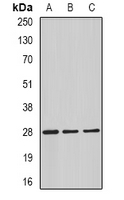 C4BPB / C4BP Beta Antibody - Western blot analysis of C4BP beta expression in HepG2 (A); mouse testis (B); rat testis (C) whole cell lysates.