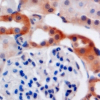 C4BPB / C4BP Beta Antibody - Immunohistochemical analysis of C4BP beta staining in mouse kidney formalin fixed paraffin embedded tissue section. The section was pre-treated using heat mediated antigen retrieval with sodium citrate buffer (pH 6.0). The section was then incubated with the antibody at room temperature and detected using an HRP conjugated compact polymer system. DAB was used as the chromogen. The section was then counterstained with hematoxylin and mounted with DPX.