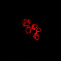 C4BPB / C4BP Beta Antibody - Immunofluorescent analysis of C4BP beta staining in HeLa cells. Formalin-fixed cells were permeabilized with 0.1% Triton X-100 in TBS for 5-10 minutes and blocked with 3% BSA-PBS for 30 minutes at room temperature. Cells were probed with the primary antibody in 3% BSA-PBS and incubated overnight at 4 deg C in a humidified chamber. Cells were washed with PBST and incubated with a DyLight 594-conjugated secondary antibody (red) in PBS at room temperature in the dark.