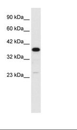 C4BPB / C4BP Beta Antibody - Fetal Liver Lysate.  This image was taken for the unconjugated form of this product. Other forms have not been tested.