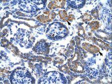 C4BPB / C4BP Beta Antibody - C4BPB antibody ARP33814_P050-NP_000707-C4BPB (complement component 4 binding protein, beta) Antibody was used in IHC to stain formalin-fixed, paraffin-embedded human kidney.  This image was taken for the unconjugated form of this product. Other forms have not been tested.