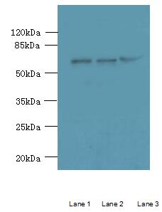 C4orf20 / UFSP2 Antibody - Western blot. All lanes: UFSP2 antibody at 4 ug/ml. Lane 1: HepG-2 whole cell lysate. Lane 2: NIH/3T3 whole cell lysate. Lane 3: Mouse kidney tissue. Secondary Goat polyclonal to Rabbit IgG at 1:10000 dilution. Predicted band size: 53 kDa. Observed band size: 53 kDa.