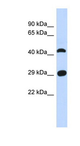 C4orf22 Antibody - C4orf22 antibody Western blot of Fetal Muscle lysate. This image was taken for the unconjugated form of this product. Other forms have not been tested.