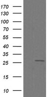 C4orf22 Antibody - HEK293T cells were transfected with the pCMV6-ENTRY control (Left lane) or pCMV6-ENTRY C4orf22 (Right lane) cDNA for 48 hrs and lysed. Equivalent amounts of cell lysates (5 ug per lane) were separated by SDS-PAGE and immunoblotted with anti-C4orf22.