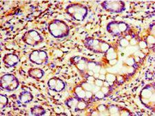 C4orf3 Antibody - Immunohistochemistry of paraffin-embedded human small intestine using antibody at 1:100 dilution.  This image was taken for the unconjugated form of this product. Other forms have not been tested.